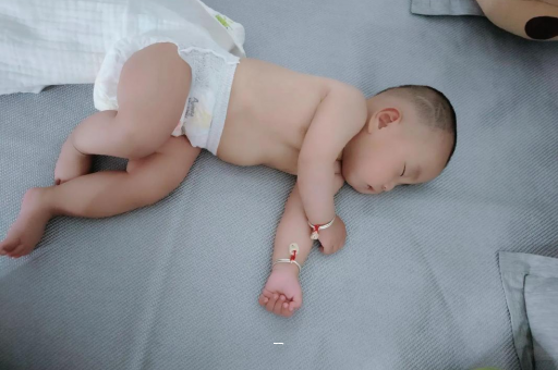 海拉尔宝宝脸上有白色斑块 海拉尔宝宝脸上有白色斑块